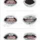 Illustration for article titled 7 Subtly Suggestive New Cover Designs For Nabokovs Lolita